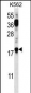 PTMS Antibody (C-term)